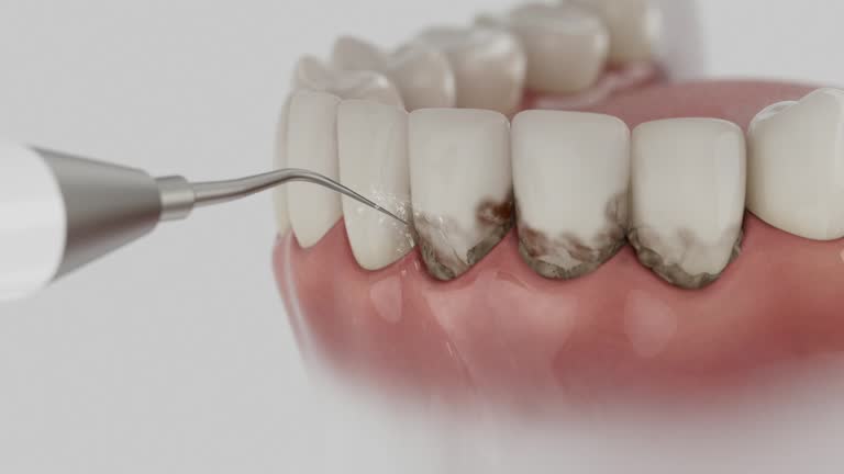 Trusted Root Canal Treatment service in Bartlesville, OK - Dentist Open Now
